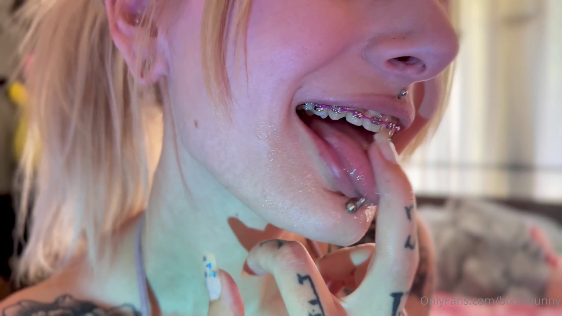 blxxdbunny - braces focused