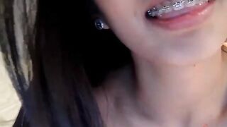Asian Chaturbate Braces Teen