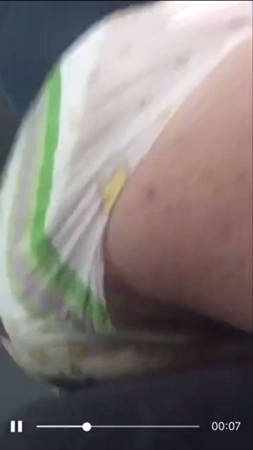 Diaper Blowout