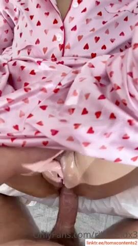 Reilly reaid pegenent anal
